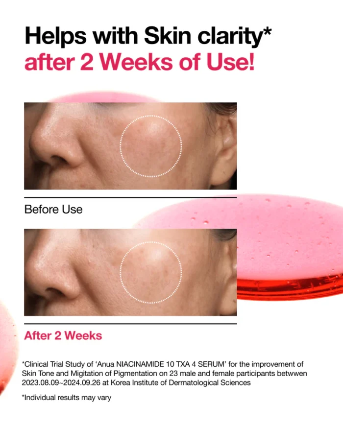 Niacinamide Serum for Dark Spots in Bangladesh 5